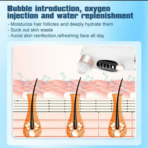 Super Micro Bubble Beauty Instrument Black Head Remover